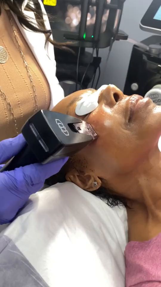 Dr. Kerline Marcelin guiding the Morpheus8 handpiece along a patient’s cheek and jaw