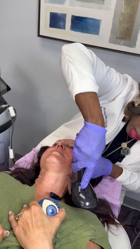 Dr. Kerline Marcelin working the Morpheus8 handpiece across a patient’s cheekbone and jawline