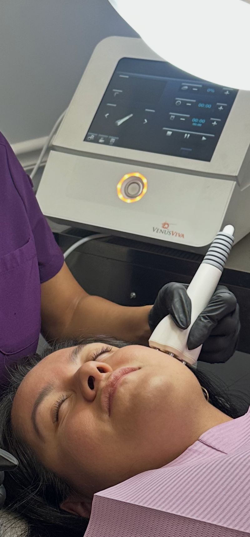 The Venus Viva handpiece against a patient’s cheek, the treatment console beside her, at Hudson Aesthetics MD