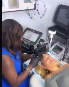 Dr. Kerline Marcelin performing a Morpheus8 radiofrequency microneedling treatment at Hudson Aesthetics.